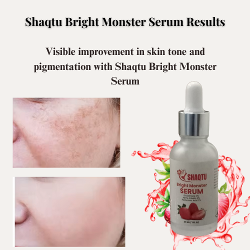 Vitamin C Brightening Serum 30ml – Dark Spot Fader & Glow Booster